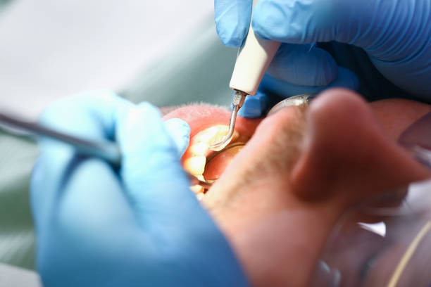 Best Tooth Infection Emergency Dentist  in Glenarden, MD