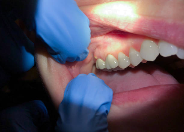 Best Tooth Pain Emergency Relief  in Glenarden, MD