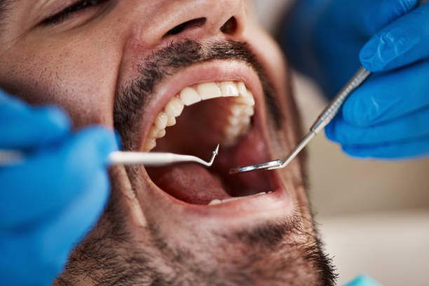 Best Dentist for Severe Toothache  in Glenarden, MD